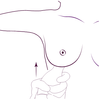 Prosedür 3. kısım