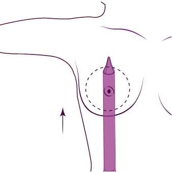 Prosedür 1. kısım